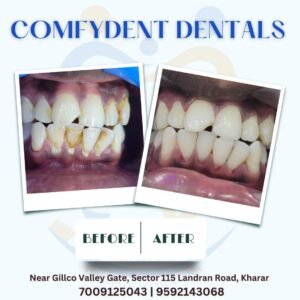 comfydent dentals clinic kharar